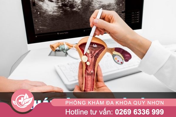 Các Bệnh Âm Đạo Phổ Biến Ở Nữ Giới