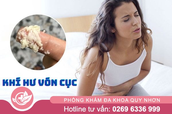 Khí Hư Vón Cục Kéo Dài Nguy Hiểm Như Thế Nào?