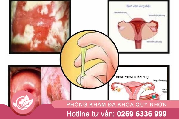 Vung-kin-ra-dich-xanh-1