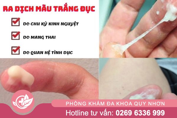 Vì sao khí hư màu trắng đục? Hiểu đúng để chăm sóc đúng