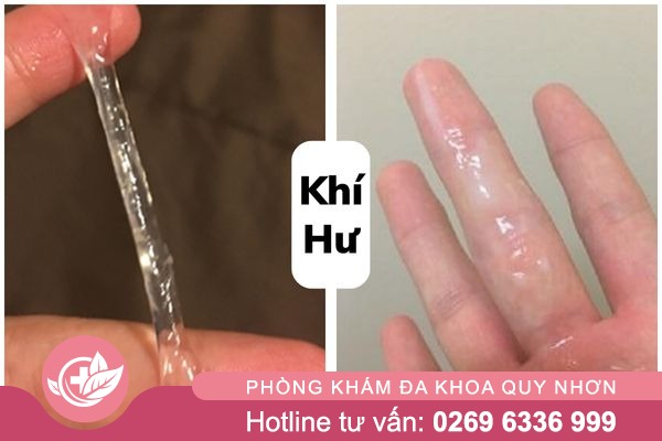 Khi-hu-bat-thuong-canh-bao-nguy-hiem-1