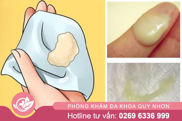 Khi-hu-bat-thuong-canh-bao-nguy-hiem-3