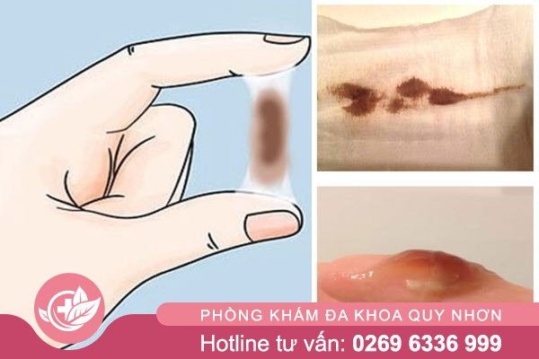 Khi-hu-bat-thuong-canh-bao-nguy-hiem-4