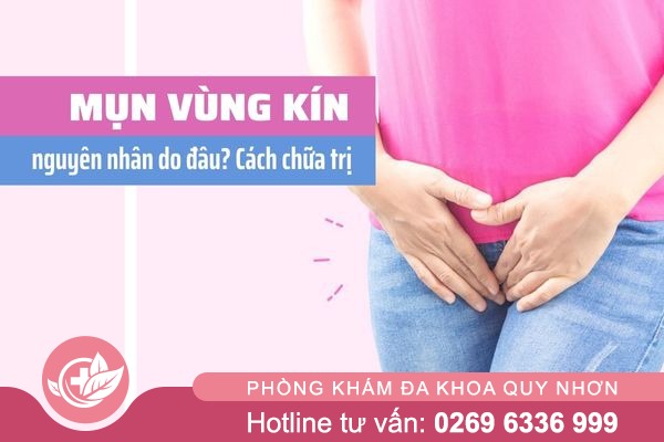 Nổi Mụn Vùng Kín Ở Phụ Nữ – Đừng Chủ Quan