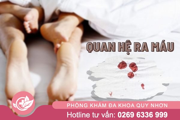Quan hệ ra máu ở nữ là do đâu? Làm thế nào để khắc phục?