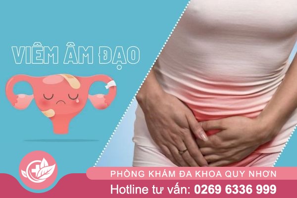 Viêm âm đạo – Cần hỗ trợ điều trị sớm tránh nguy cơ vô sinh