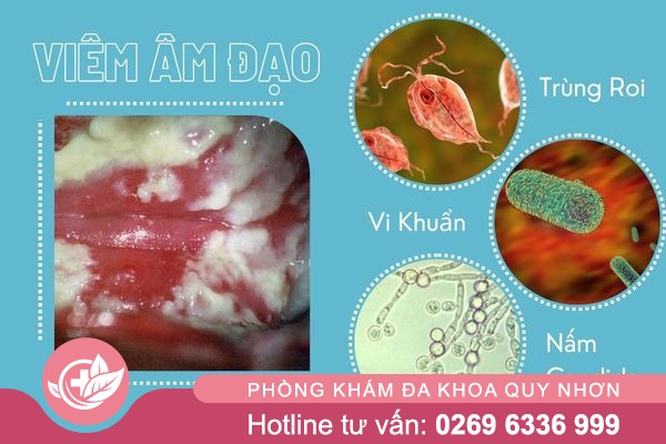 Tong-hop-nhung-su-that-ve-viem-am-dao-1