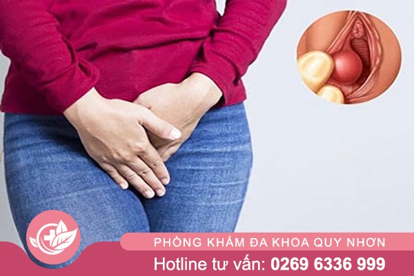 Hạch Vùng Kín Ảnh Hưởng Gì Đến Sức Khỏe Sinh Sản?