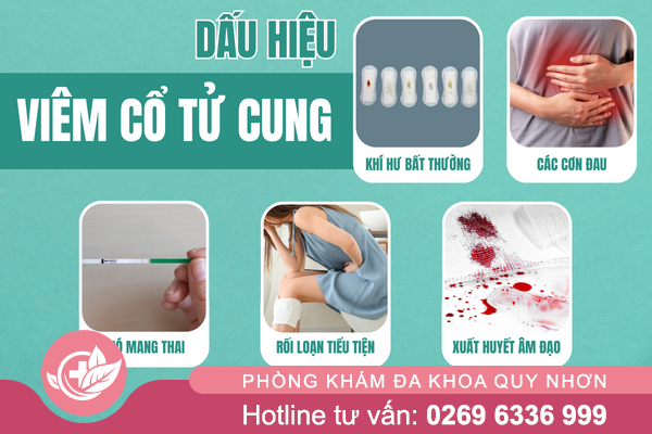 Viem-co-tu-cung-va-nhung-thong-tin-can-biet-2