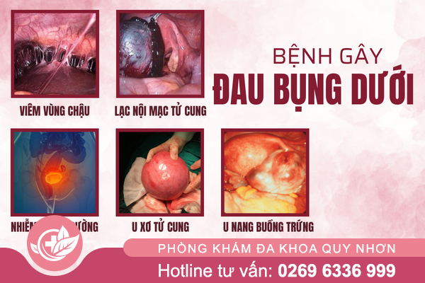 Dau-bung-duoi-la-bi-gi-1