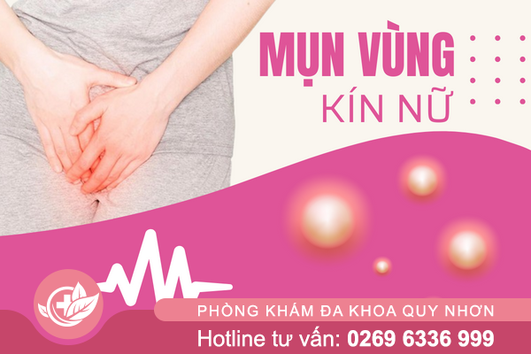 Nổi Mụn Vùng Kín Ở Phụ Nữ – Đừng Chủ Quan