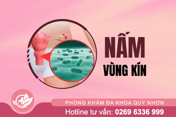 Nấm vùng kín là gì? Nguyên nhân và dấu hiệu nhận biết