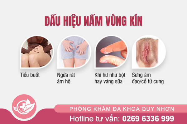 Su-that-ve-benh-nam-vung-kin-2