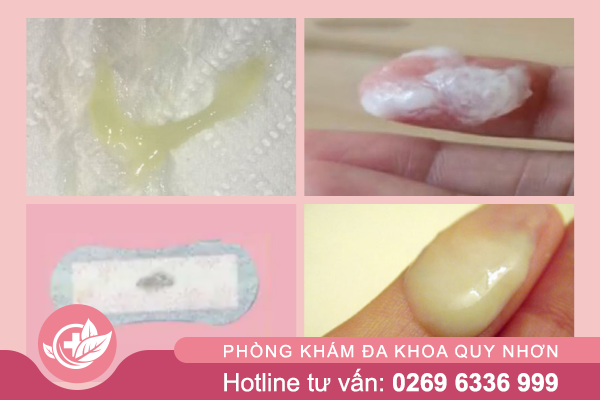 Ban-da-hieu-dung-ve-khi-hu-bat-thuong-chua-2