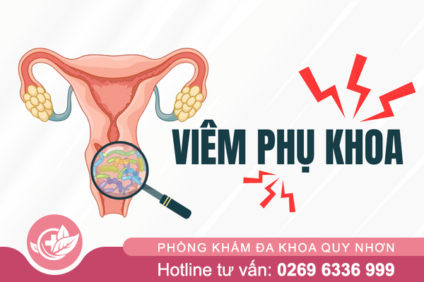 Viêm phụ khoa có nguy hiểm không? Cách chữa bạn cần biết