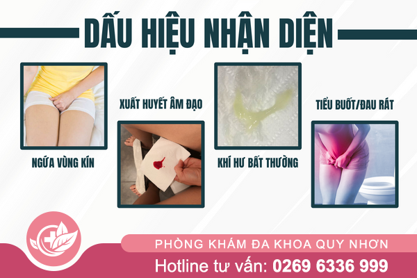 Viem-phu-khoa-dau-hieu-nguyen-nhan-va-cach-chua-tri-1