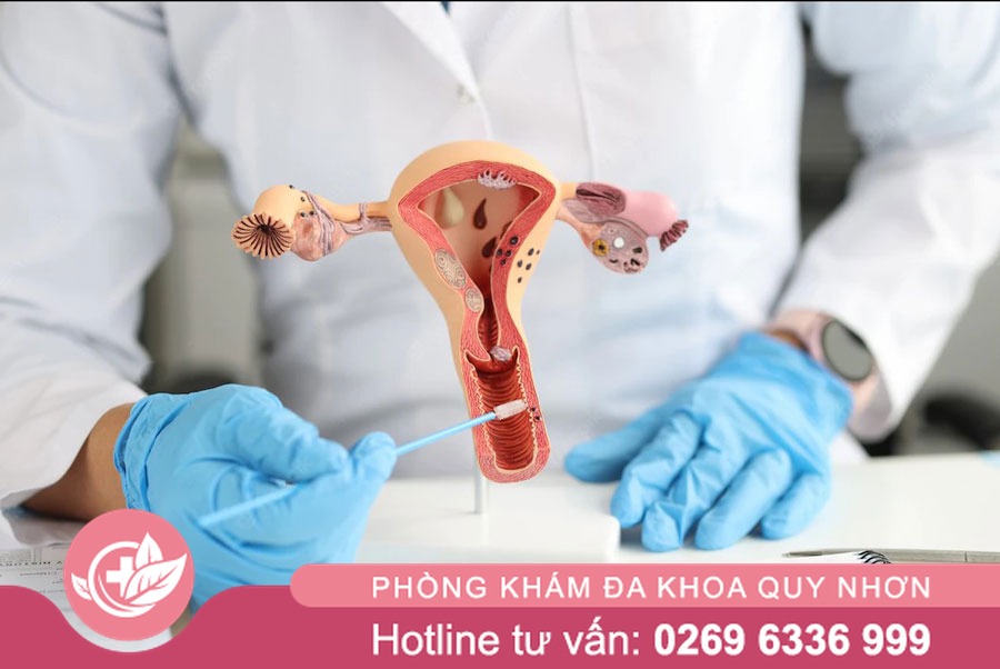 Khám Phụ Khoa Hết Bao Nhiêu Tiền? Chị Em Cần Biết