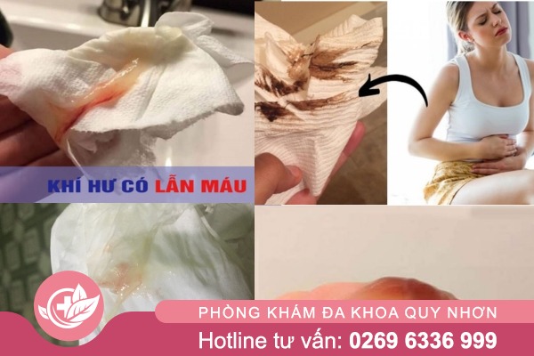 Khí hư có máu là bị bệnh gì?