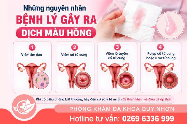 Ra Dịch Màu Hồng Khi Nào Cần Đi Khám Phụ Khoa?