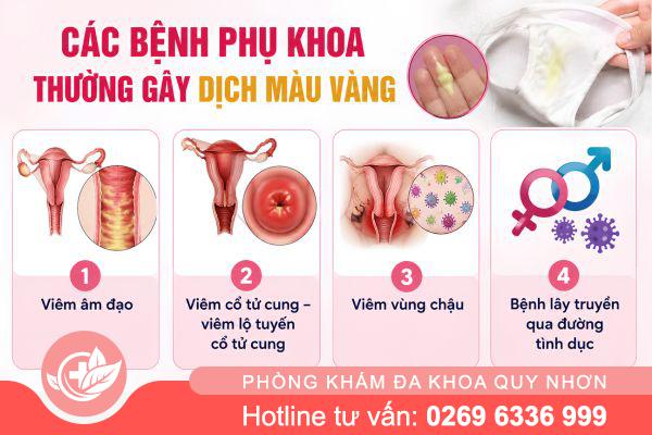Dịch Màu Vàng Ở Vùng Kín – Dấu Hiệu Viêm Nhiễm Nguy Hiểm