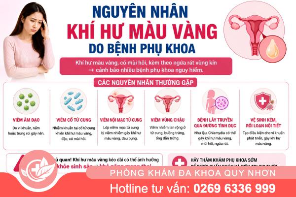 Khí Hư Màu Vàng – Dấu Hiệu Viêm Nhiễm Cần Lưu Ý