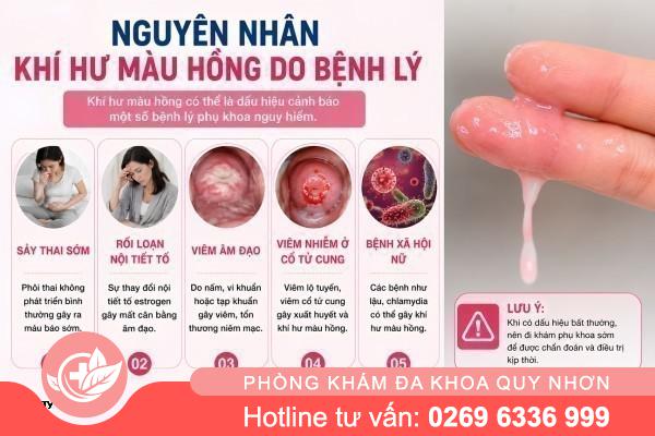 Vì Sao Khí Hư Có Màu Hồng Bất Thường?