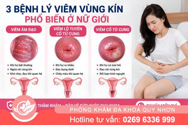 Viêm Vùng Kín Ở Nữ Giới: Dấu Hiệu Không Nên Bỏ Qua