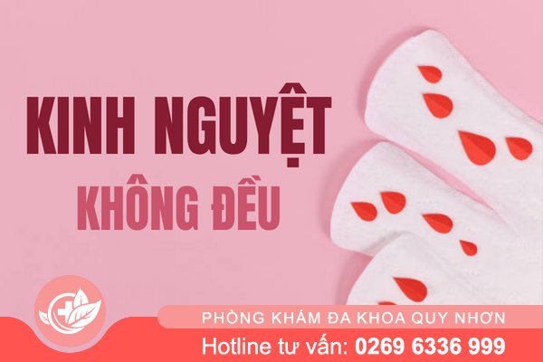Kinh nguyệt không đều – Chị em phụ nữ phải làm sao?