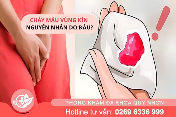 Một dấu hiệu nhỏ – chảy máu vùng kín có thể cảnh báo bệnh lớn