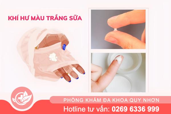 Hiểu đúng về khí hư có màu trắng sữa để bảo vệ sức khỏe