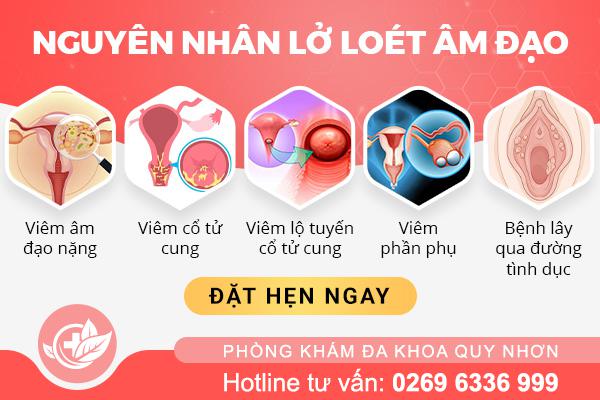 Lở loét âm đạo: Vấn đề nhạy cảm nhưng không nên bỏ qua