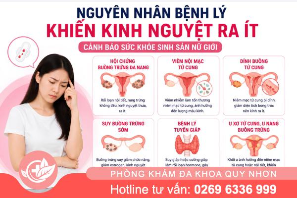 Kinh Nguyệt Ra Ít Là Bị Gì? Nguyên Nhân, Dấu Hiệu Và Cách Điều Trị